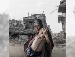 Gazze’de Açlıktan Can Kaybı Artıyor: 93’ü Çocuk 180 Ölü