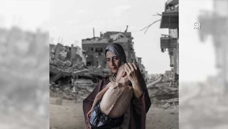 Gazze’de Açlıktan Can Kaybı Artıyor: 93’ü Çocuk 180 Ölü